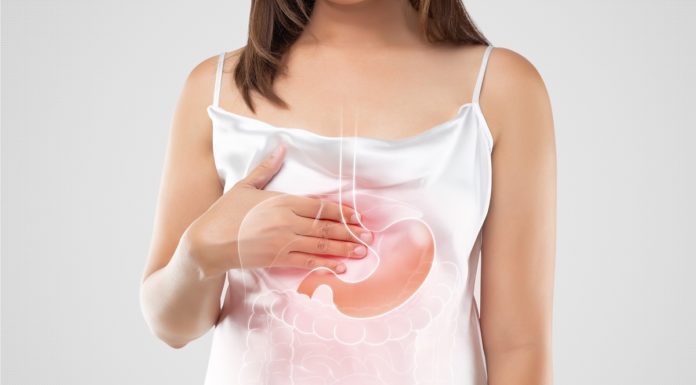 Oesophageal cancer is thirty times more common in patients with Barrett’s oesophagus